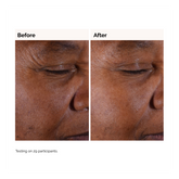 The Ordinary Glycolic Acid 7% Exfoliating Toner 100ml - Sense42 Beauty and Health