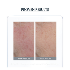 Eucerin Anti-Redness Soothing Care Cream - Sense42 Beauty and Health