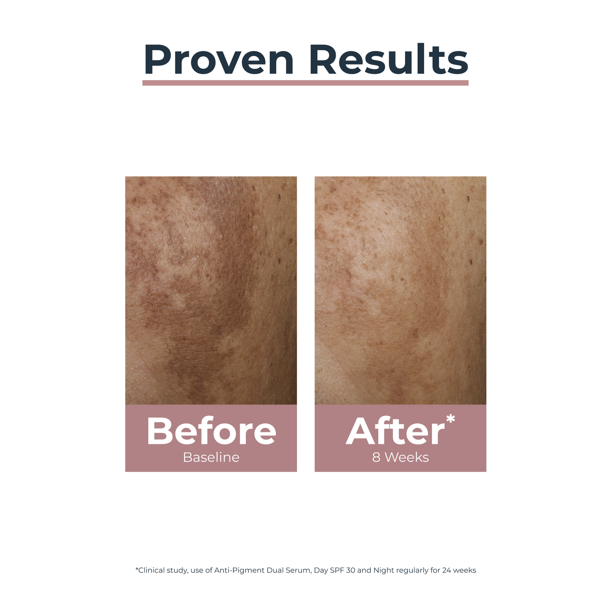Eucerin Anti-Pigment Perfector Night Care