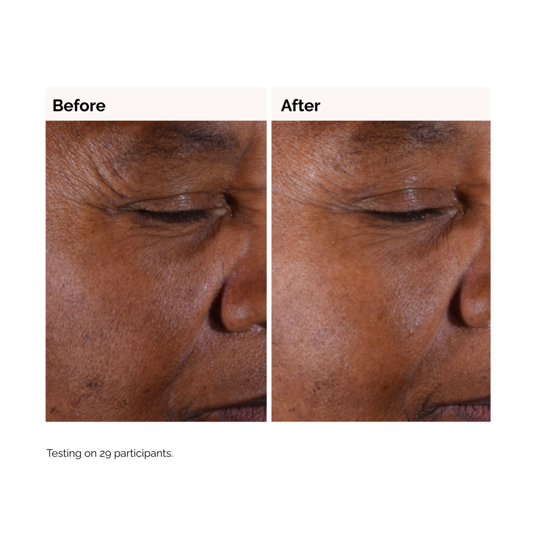 The Ordinary Glycolic Acid 7% Exfoliating Toner 100ml - Sense42 Beauty and Health