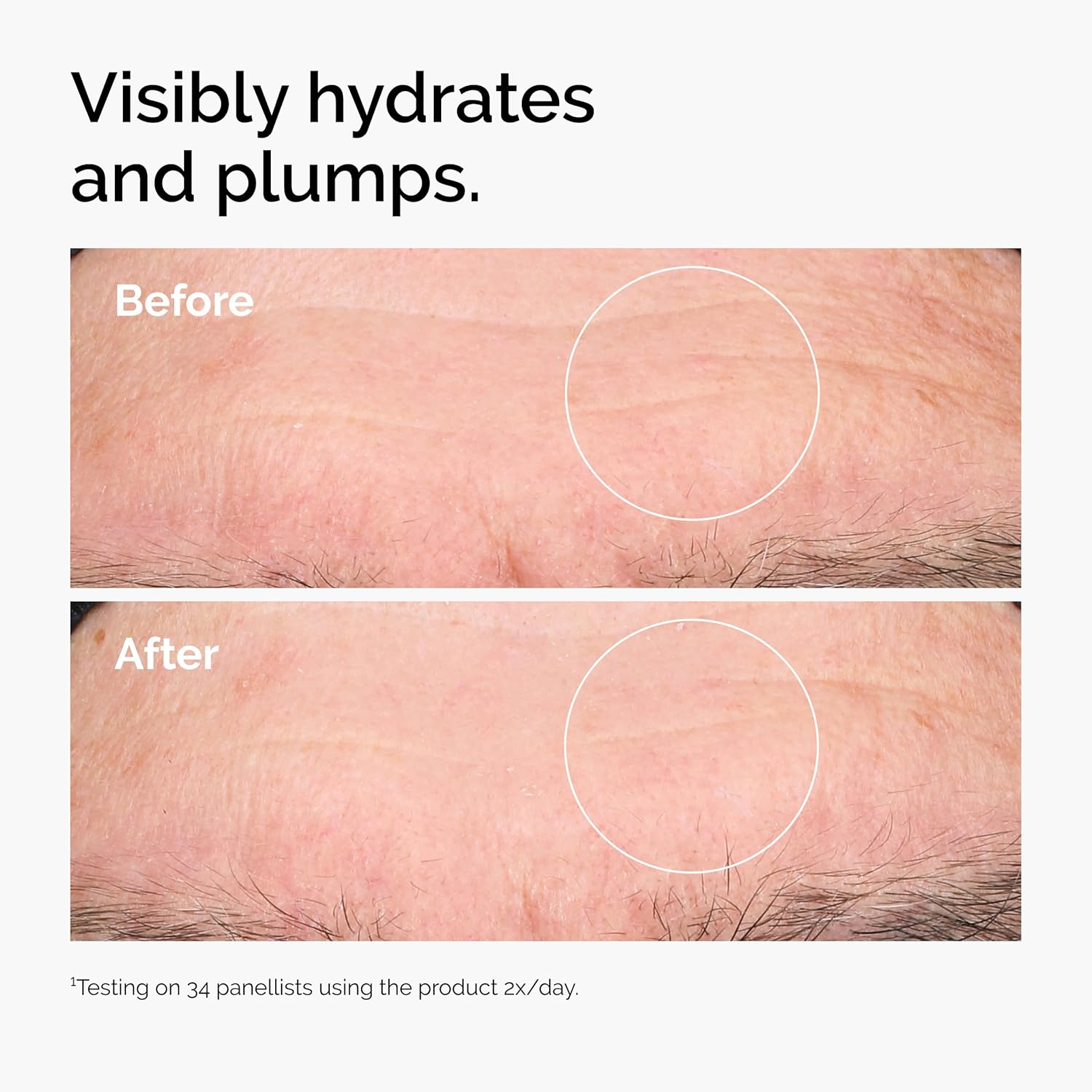 The Ordinary Hyaluronic Acid 2% + B5 30ml