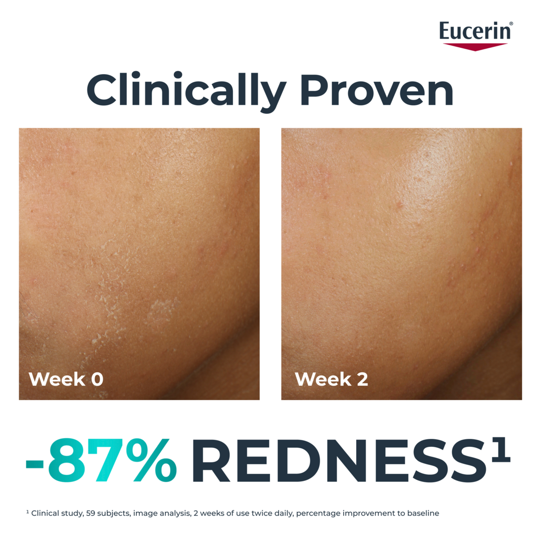 Eucerin Dermopure Hydra Repair Soothing Cream 50ml - Sense42 Beauty and Health