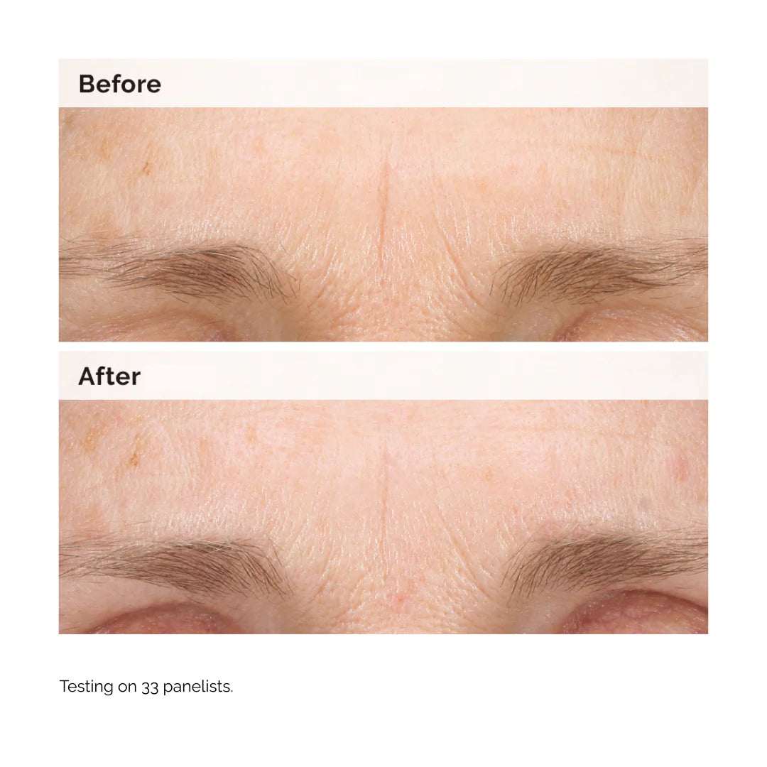 The Ordinary Retinal 0.2% Emulsion 15ml