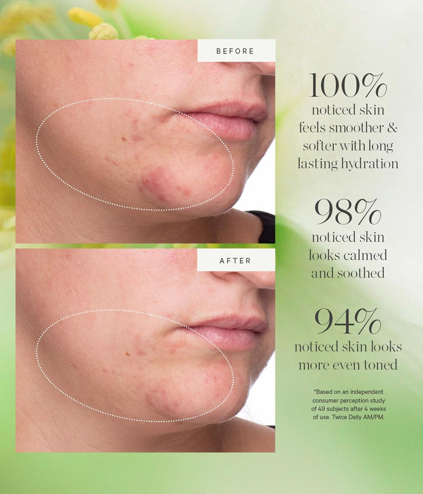 KORA Organics Active Algae Lightweight Moisturizer