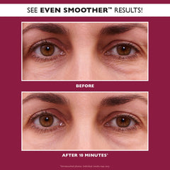 Peter Thomas Roth EVEN SMOOTHER™ Glycolic Retinol Hydra-Gel Eye Patches