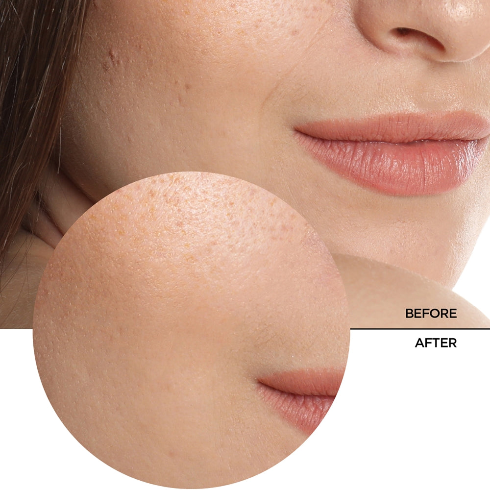 Revox B77 JUST Hyaluronic Acid 5%